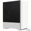 Kép 4/4 - Zalman S5 Window White gépház